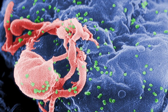 Virus HIV AIDS Mematiakan