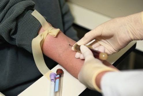 Pemeriksaan Darah yang Tepat Untuk Mendeteksi Penyakit Herpes